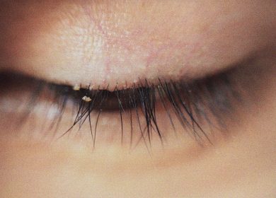 Eyelash Mites: Symptoms, Causes, and How to Treat Them