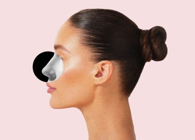 I Got a Revision Rhinoplasty to Fix My Nose Job—Before & After Photos