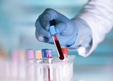 Shortcomings and Problems with Blood Lab Tests