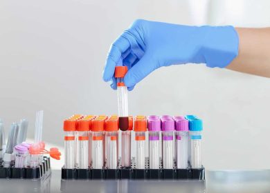 Which Blood Tests When Taking Rapamycin?