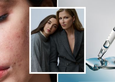 I Visited the First Walk-In Acne-Only Skin Clinic | Spotless Review